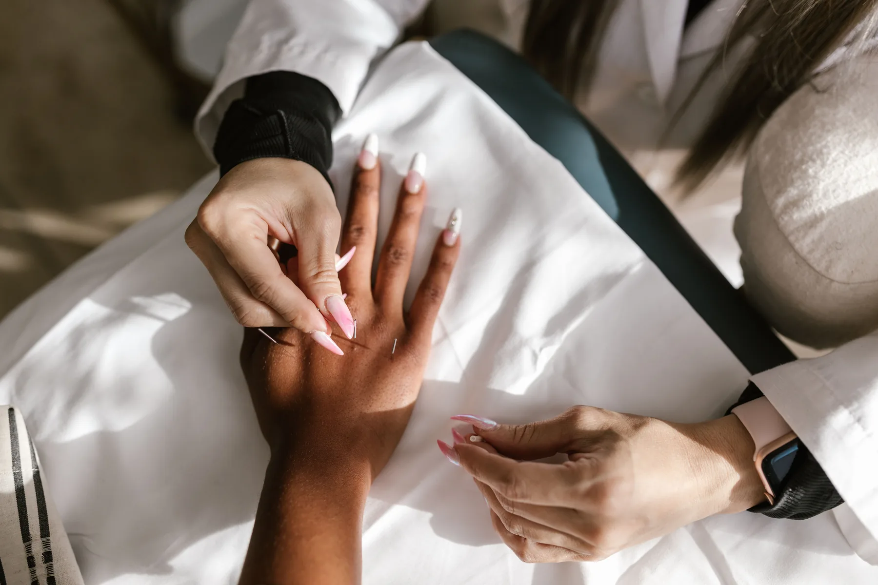 A practitioner&rsquo;s hands supporting a client&rsquo;s hand over white linen during an acupuncture session.