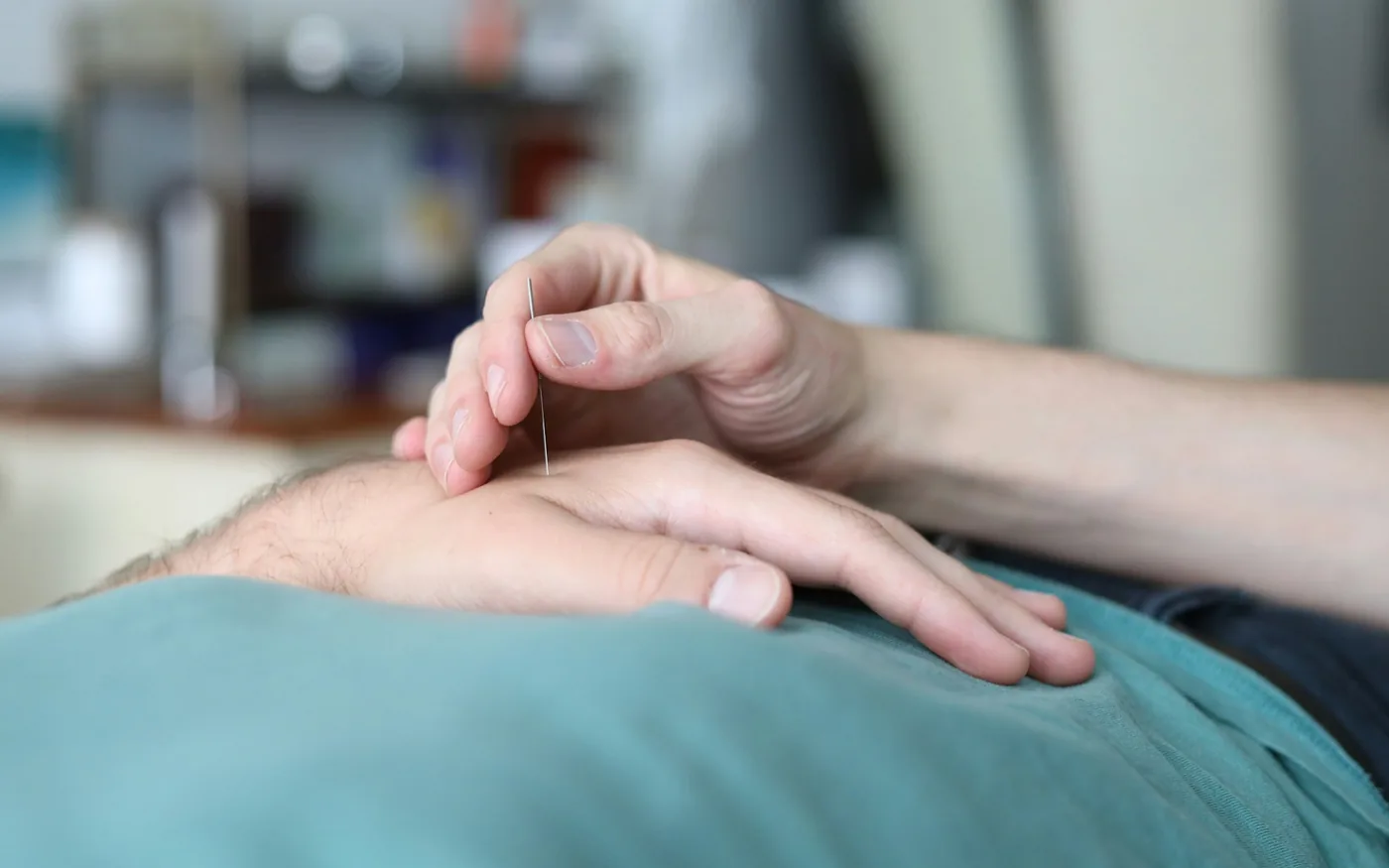 Acupuncture for Back Pain: What the Evidence Shows and What to Expect