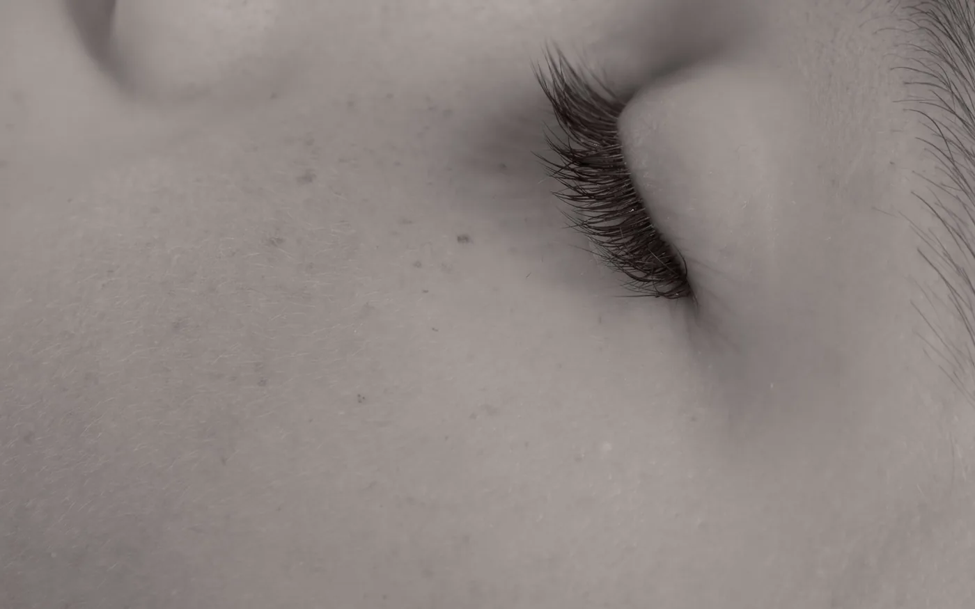 Acupuncture for Migraines and Tension Headaches: What to Expect