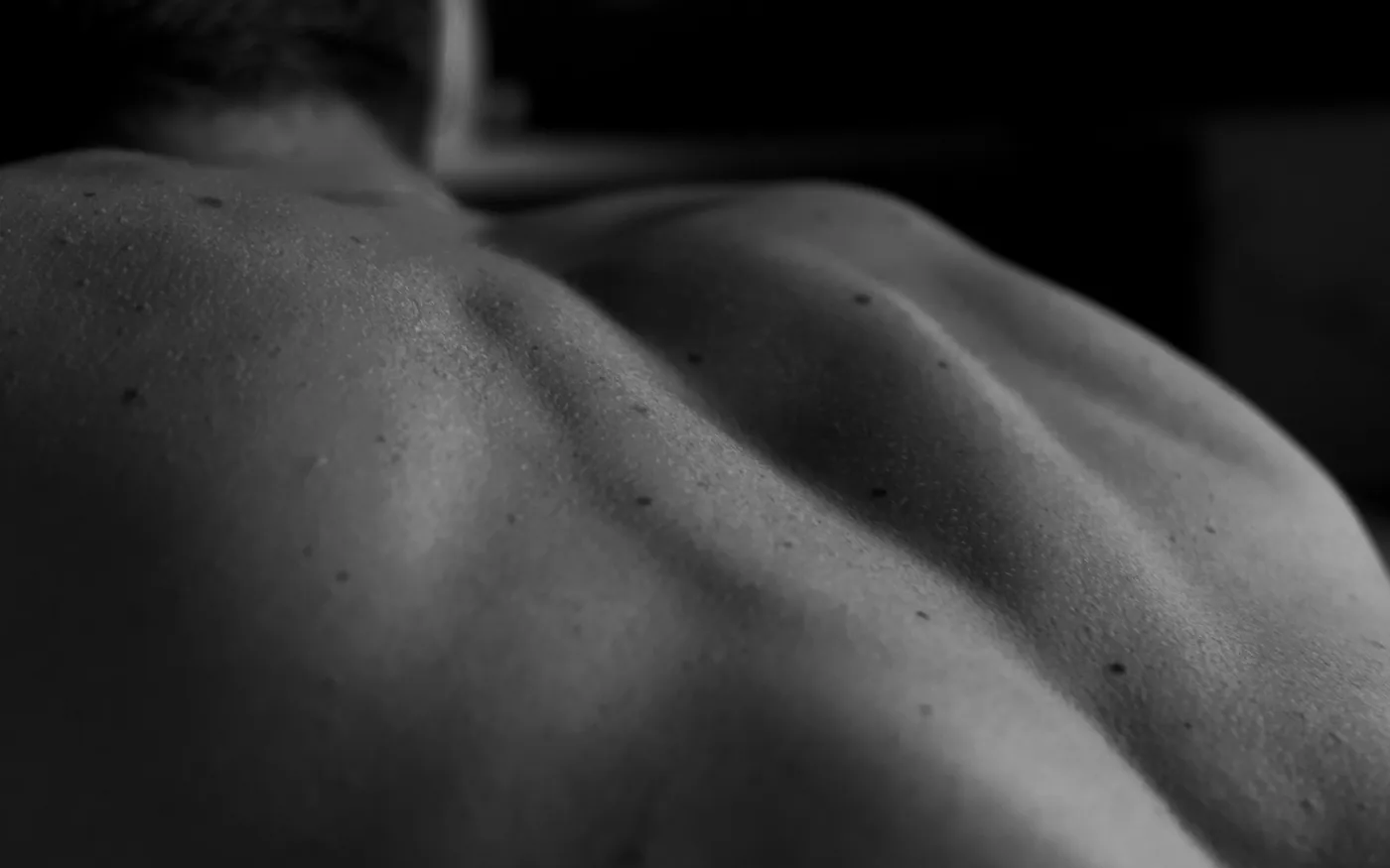 Needling addresses the muscular guarding that builds around an irritated nerve