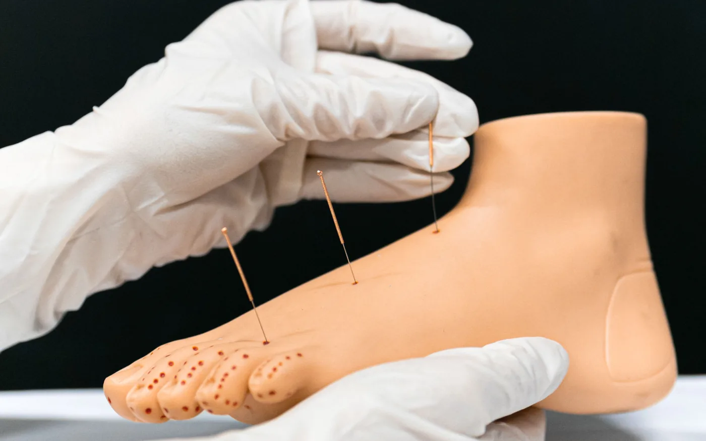 Needling addresses the calf complex rather than the tendon itself