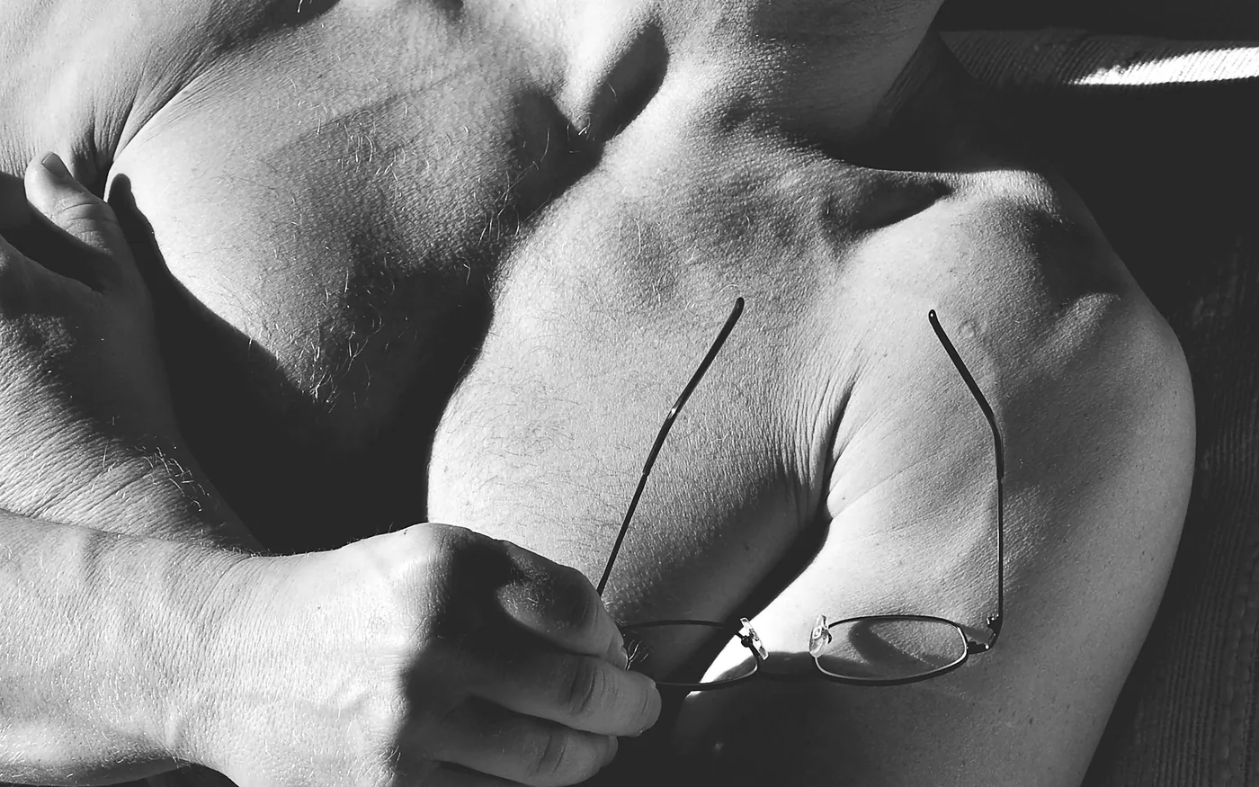 Acupuncture needles placed during a treatment session