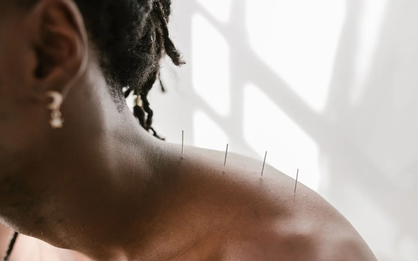 Needling addresses the cuff, the shoulder blade muscles and the neck