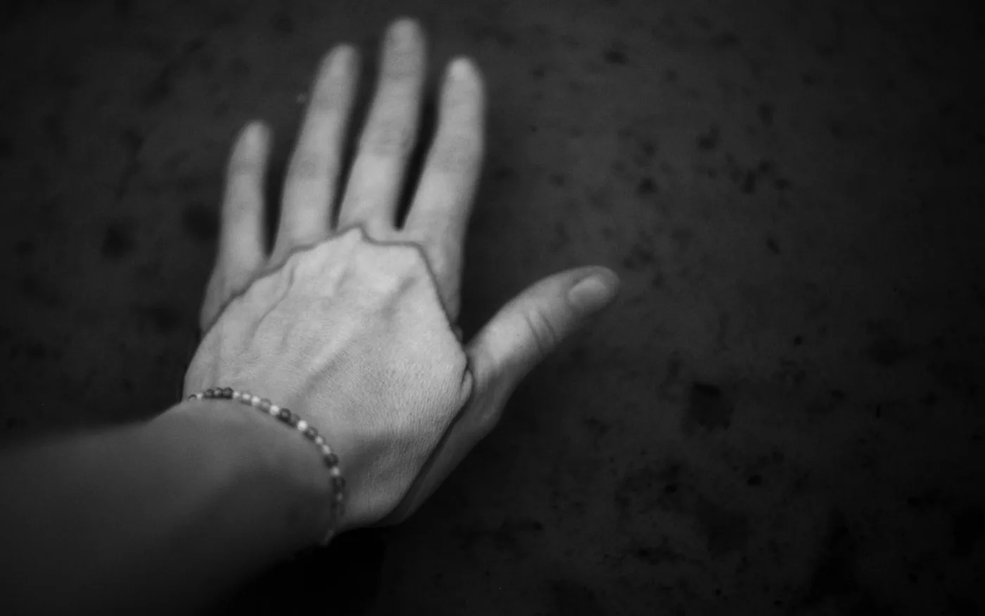 Points on the hand and wrist, commonly used in treatment for anxiety