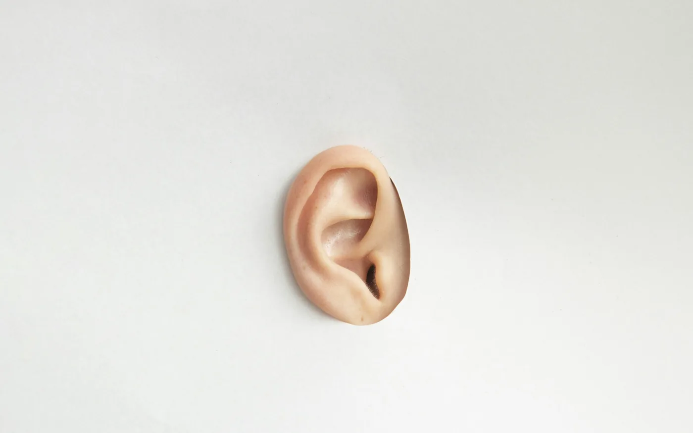 Fine needles placed at auricular points on the outer ear