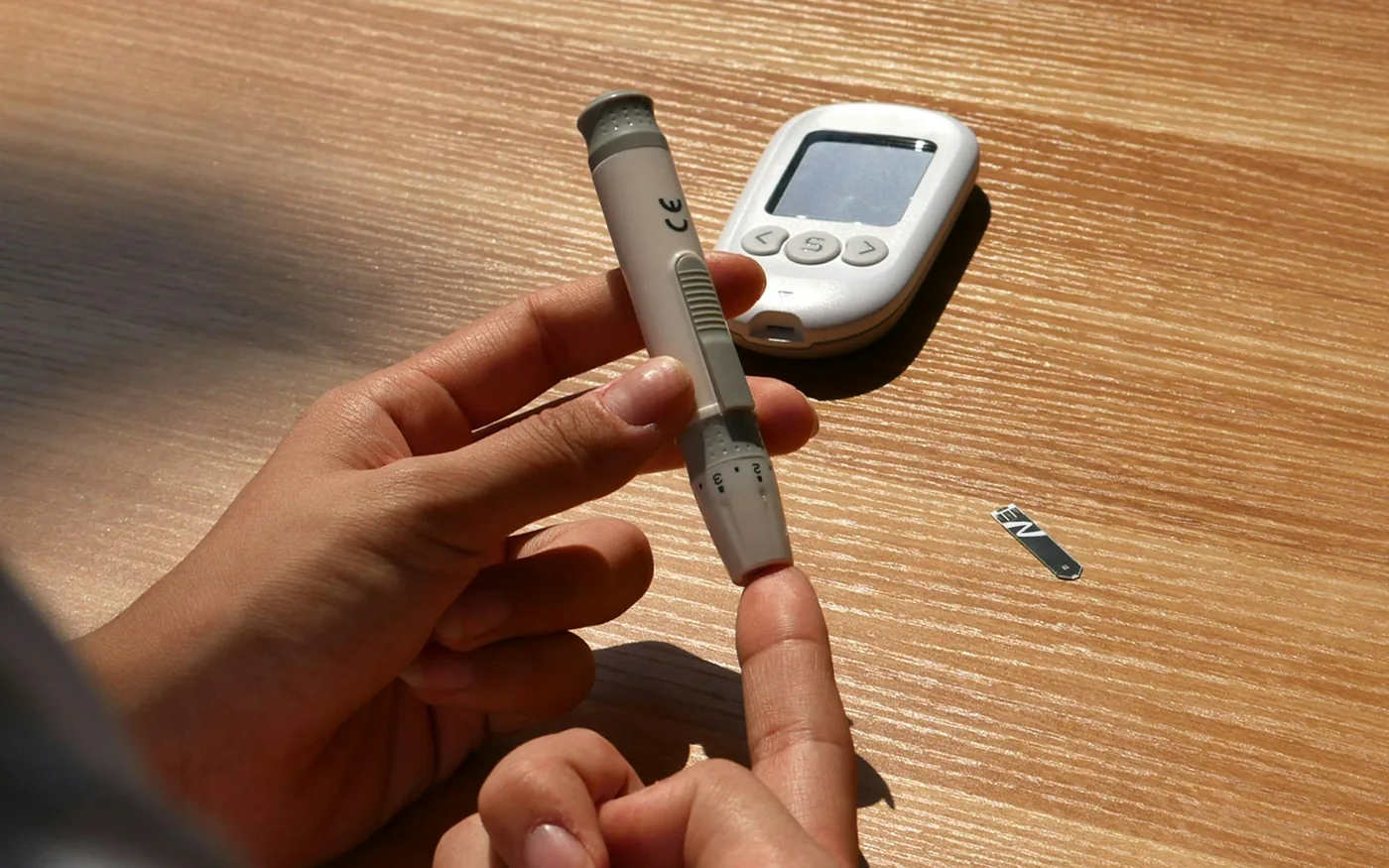 Diabetes is the commonest cause of peripheral neuropathy