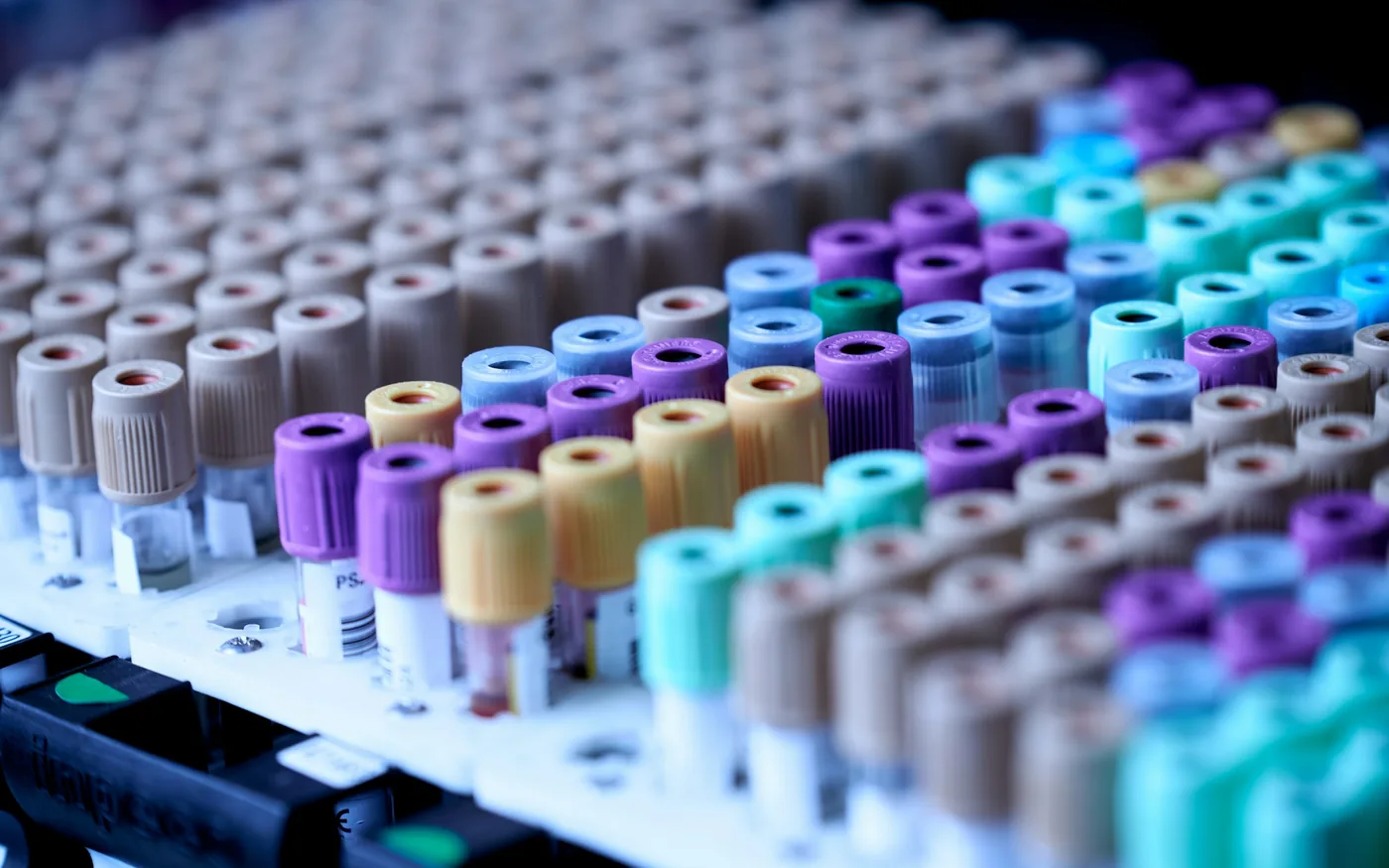 Blood tests look for treatable causes such as B12 deficiency or thyroid disease