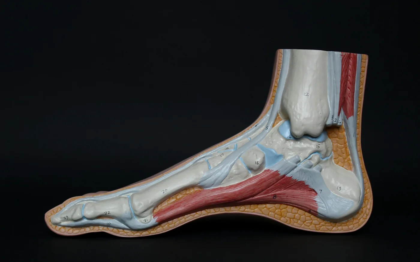The bony bump sits on top of the joint rather than at the side