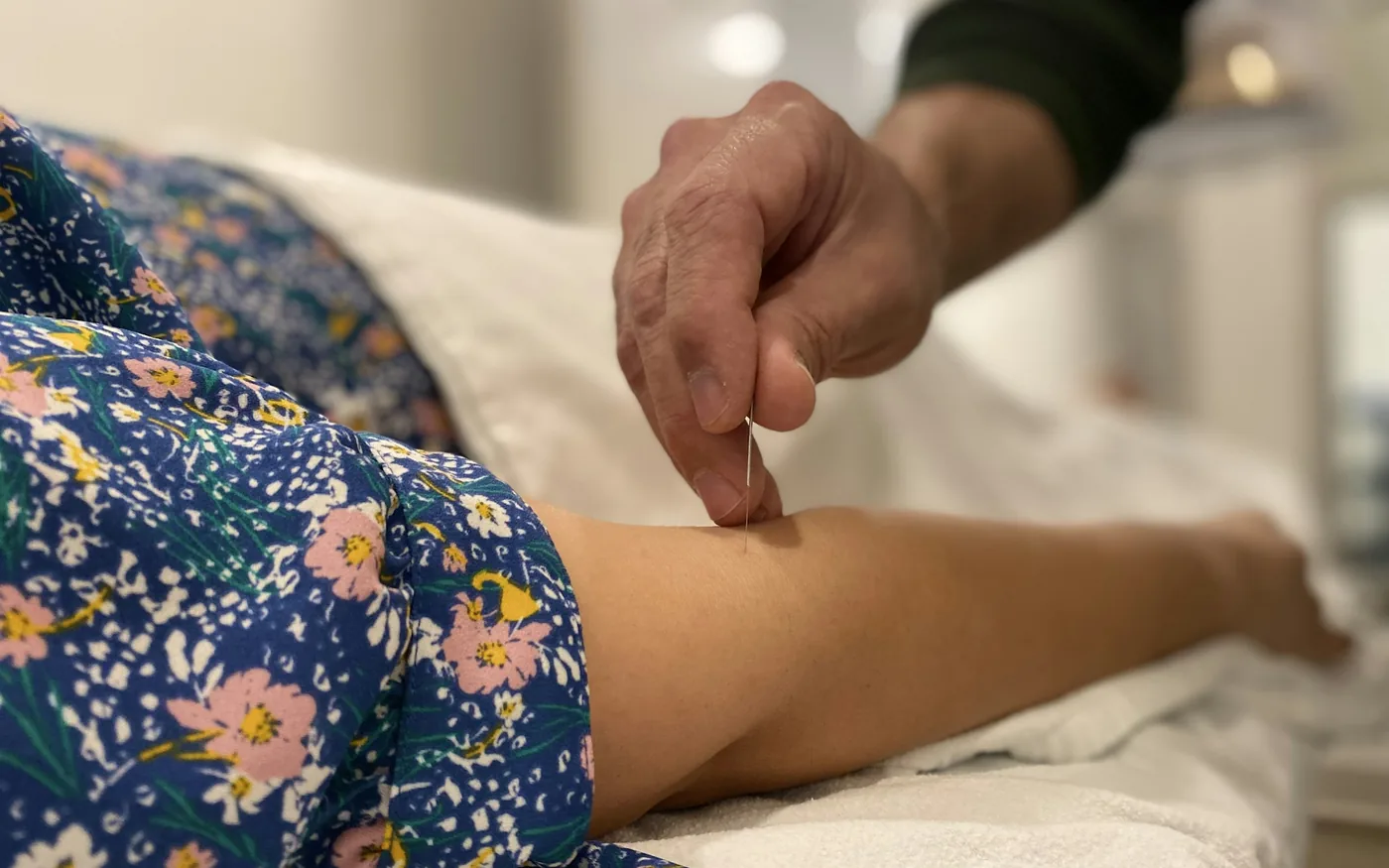 A licensed acupuncturist placing needles during a treatment
