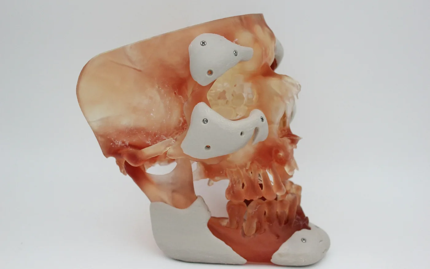 The sciatic nerve passes through the deep buttock alongside several muscles