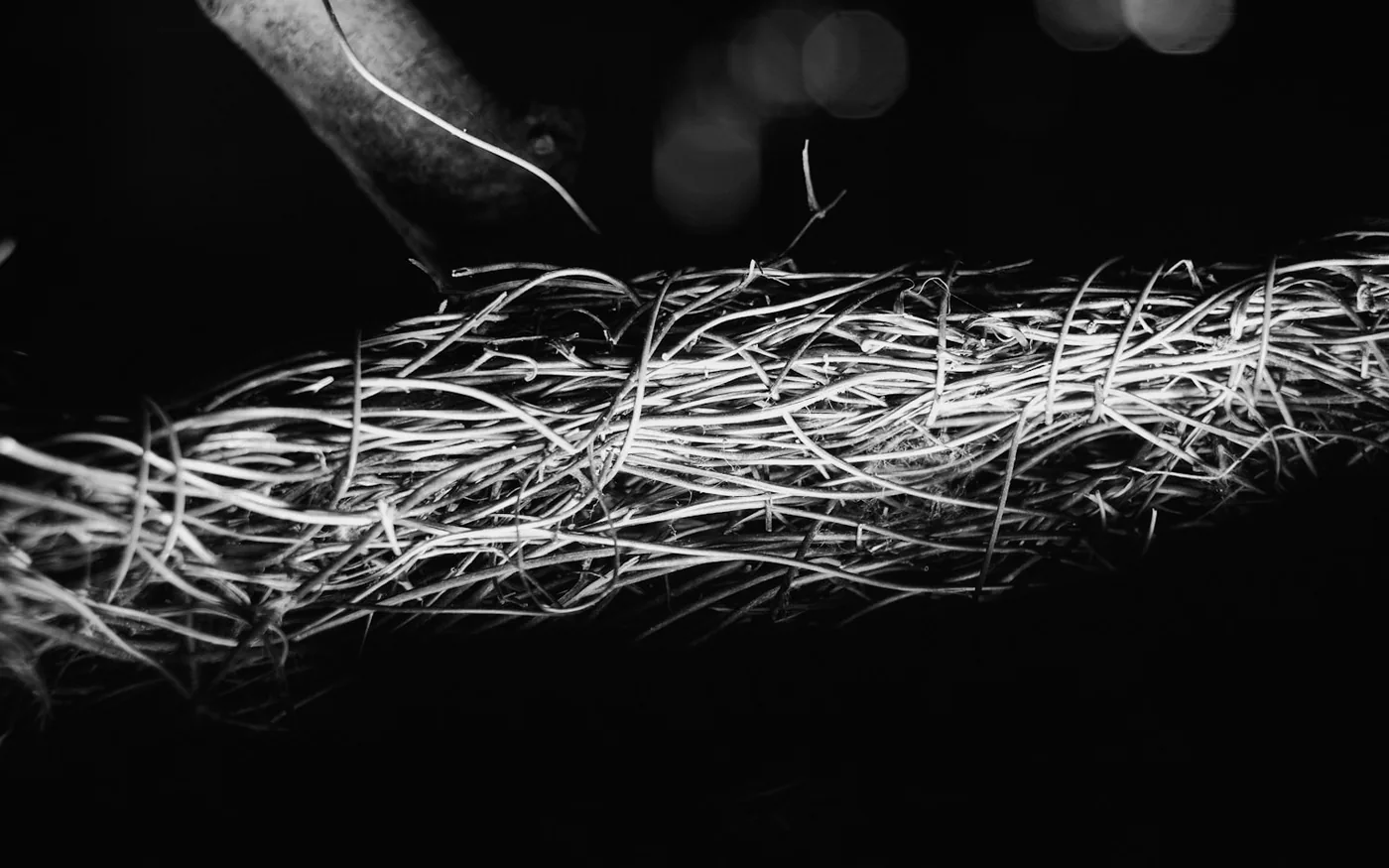 Does Acupuncture Hurt? What a First Session Is Really Like