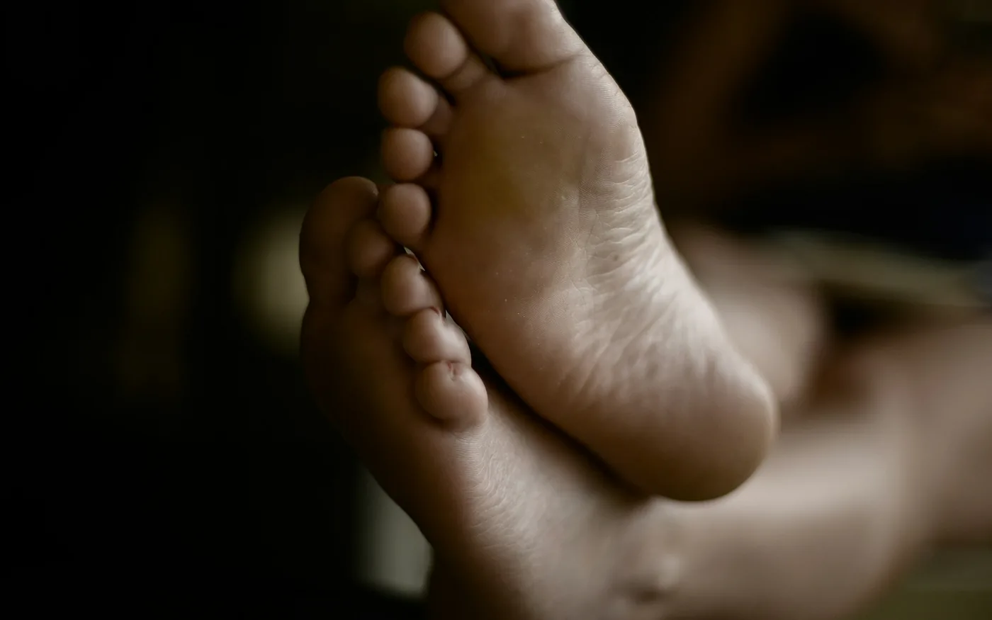 Gout classically strikes the joint at the base of the big toe
