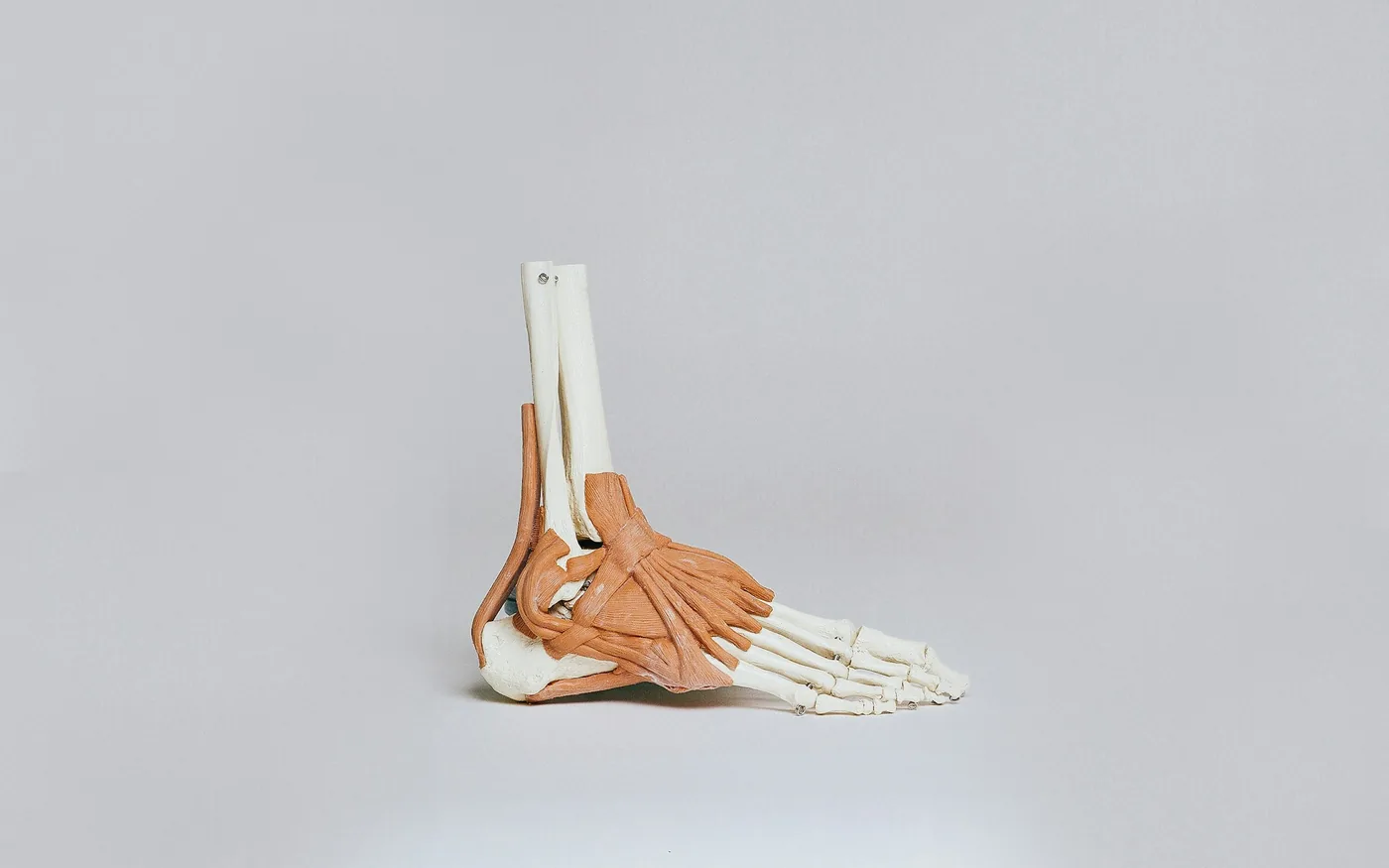 The joint sits deep in the groin, which is where its pain is felt
