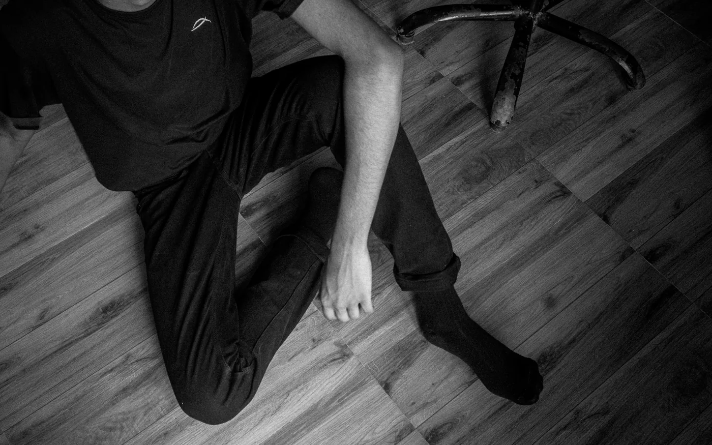A degenerative meniscal tear rarely announces itself with a single injury
