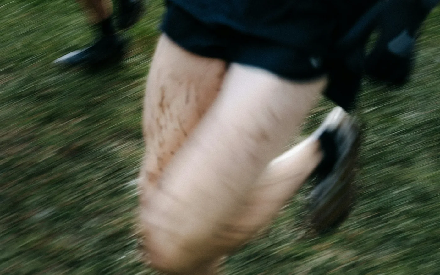 Shin splints cause diffuse ache along the inner border of the shin bone
