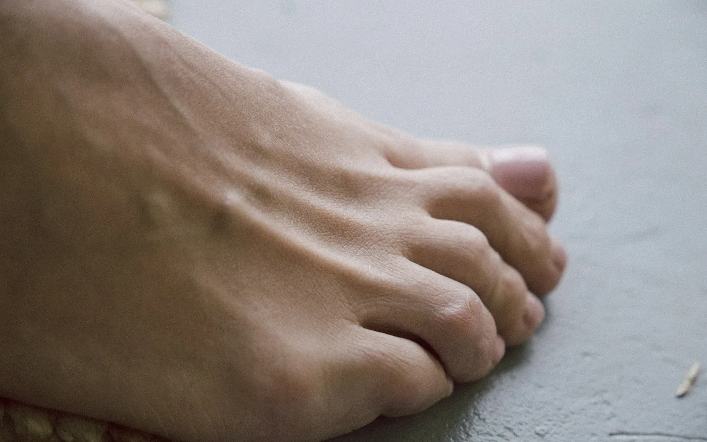 Stiffness and pain at the big toe joint, worse pushing off