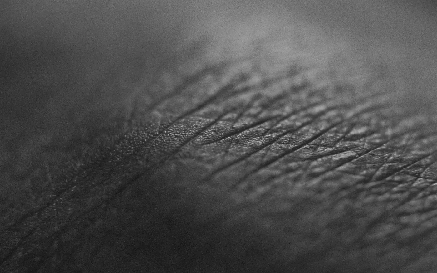 Sudden swelling or discolouration of the arm needs urgent assessment