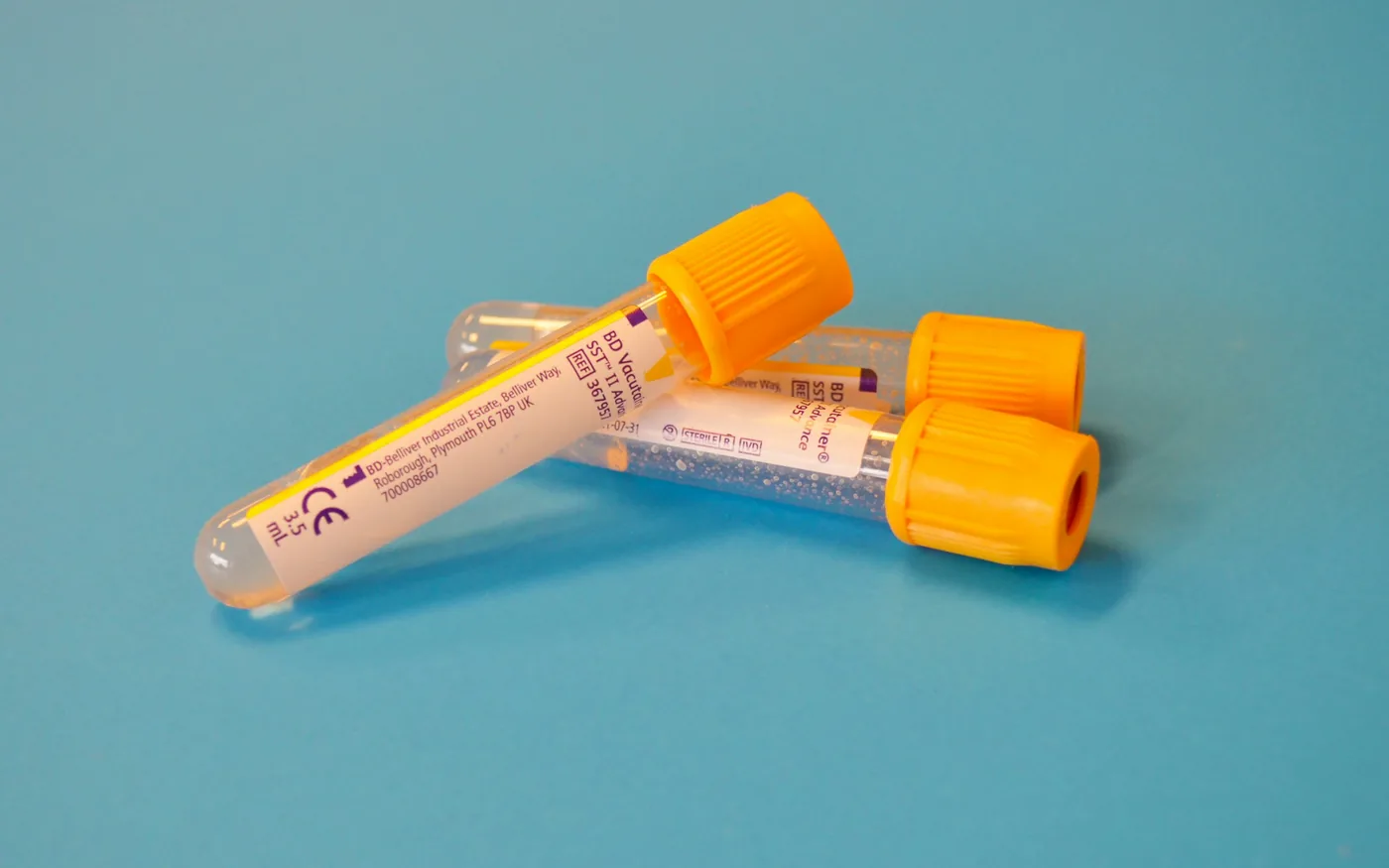 Urate levels guide the treatment that actually prevents attacks